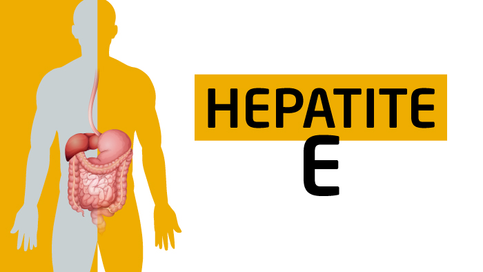 Hepatite E